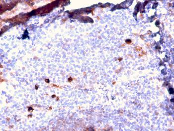 Anti-IgM (Immunoglobulin Mu Heavy Chain) (B-Cell Marker) Monoclonal Antibody(Clone: IGHM/2557R)