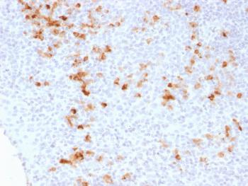 Anti-Kappa Light Chain (B-Cell Marker) Monoclonal Antibody(Clone: KLC1278)