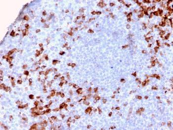 Anti-Kappa Light Chain / IGKC (B-Cell Marker) Monoclonal Antibody(Clone: KLC2886R)