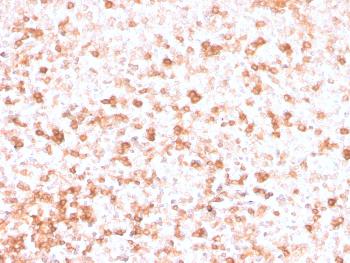 Anti-Lambda Light Chain (B-Cell Marker) Monoclonal Antibody(Clone: rLLC/3777)