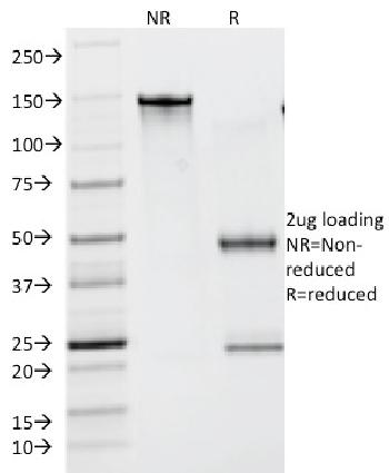 Anti-Lambda Light Chain (B-Cell Marker) Monoclonal Antibody(Clone: N10/2)