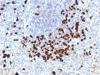 Anti-Lambda Light Chain (B-Cell Marker) Monoclonal Antibody(Clone: LLC/1738)