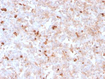 Anti-Lambda Light Chain (B-Cell Marker) Monoclonal Antibody(Clone: rLLC/1738)