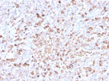 Anti-Lambda Light Chain (B-Cell Marker) Monoclonal Antibody(Clone: LLC/3778R)