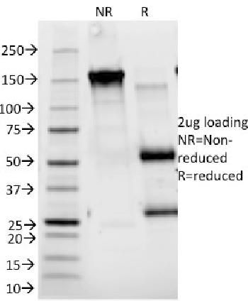 Anti-CD25 / IL2RA (Activated Lymphocyte Marker) Monoclonal Antibody(Clone: 143-13)