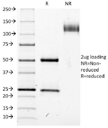 Anti-CD25 / IL2RA (Activated Lymphocyte Marker) Monoclonal Antibody(Clone: IL2RA/423)