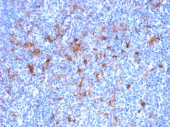 Anti-CD25 / IL2RA (Activated Lymphocyte Marker) Monoclonal Antibody(Clone: IL2RA/2395)