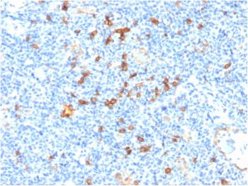 Anti-IL3RA / CD123 (Acute Myeloid Leukemia Marker) Monoclonal Antibody(Clone: IL3RA/1531)