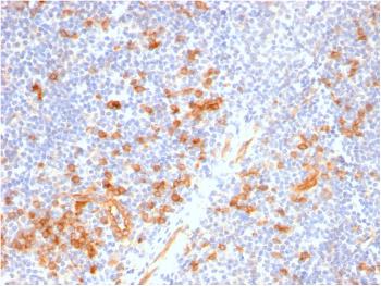 Anti-IL3RA / CD123 (Acute Myeloid Leukemia Marker) Monoclonal Antibody(Clone: IL3RA/2947R)