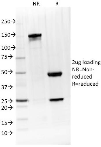 Anti-IL-4 / Interleukin 4 Monoclonal Antibody(Clone: IL4/1597)