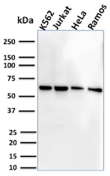 Anti-CD127 / IL7R (Marker of T-Reg Cells) Monoclonal Antibody(Clone: IL7R/2751)