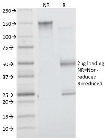 Anti-Insulin Receptor Alpha Monoclonal Antibody(Clone: INSR/1661)