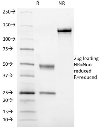 Anti-CD41a / Integrin-b (Platelet Marker) Monoclonal Antibody(Clone: ITGA2B/1036)