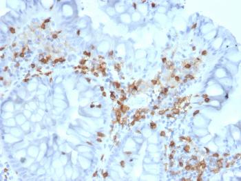 Anti-CD103 / Integrin 'E'7 (T-Cell Lymphoma & Hairy Cell Leukemia Marker) Monoclonal Antibody(Clone: ITGAE/2063)