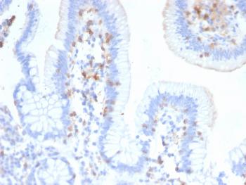 Anti-CD103 / Integrin alpha E (T-Cell Lymphoma & Hairy Cell Leukemia Marker) Monoclonal Antibody(Clone: ITGAE/2474)