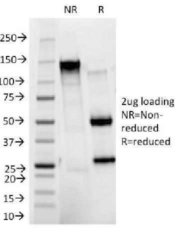 Anti-CD11b / MAC-1 (Microglial Marker) Monoclonal Antibody(Clone: ITGAM/271)