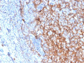 Anti-CD11b / MAC-1 (Microglial Marker) Monoclonal Antibody(Clone: ITGAM/3337)