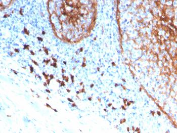 Anti-CD11b / MAC-1 (Microglial Marker) Monoclonal Antibody(Clone: ITGAM/3339)