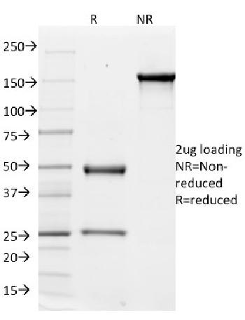 Anti-CD51 / Integrin V Monoclonal Antibody(Clone: ITGAV/1610)