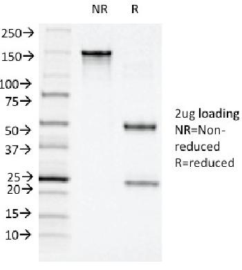 Anti-CD11c (Dendritic Cell Marker) Monoclonal Antibody(Clone: ITGAX/1243)