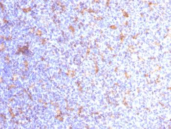 Anti-CD11c (Dendritic Cell Marker) Monoclonal Antibody(Clone: ITGAX/1284)