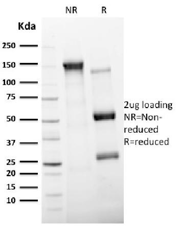 Anti-CD11c (Dendritic Cell Marker) Monoclonal Antibody(Clone: ITGAX/2507)