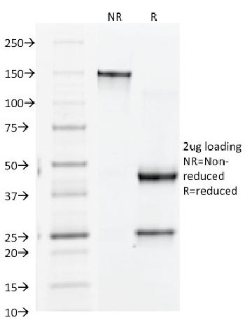 Anti-CD61 / Integrin 3 / Platelet Glycoprotein IIIa (Platelet Marker) Monoclonal Antibody(Clone: Y2/51)