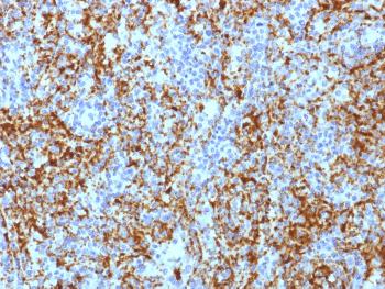 Anti-CD61 / Integrin 3 / Platelet Glycoprotein IIIa (Platelet Marker) Monoclonal Antibody(Clone: ITGB3/1713)