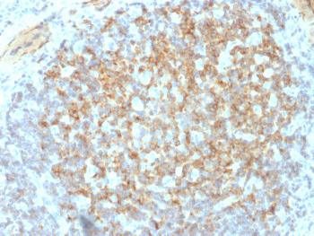 Anti-CD61 / Integrin 3 / Platelet Glycoprotein IIIa (Platelet Marker) Monoclonal Antibody(Clone: ITGB3/2145)