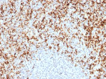 Anti-CD61 / Integrin 3 / Platelet Glycoprotein IIIa (Platelet Marker) Monoclonal Antibody(Clone: ITGB3/2597)