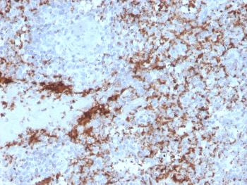 Anti-CD61 / Integrin '3 / Platelet Glycoprotein IIIa (Platelet Marker) Monoclonal Antibody(Clone: rITGB3/2145)