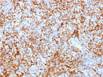 Anti-CD61 / Integrin 3 / Platelet Glycoprotein IIIa (Platelet Marker) Monoclonal Antibody(Clone: ITGB3/2166R)