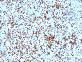 Anti-CD61 / Integrin 3 / Platelet Glycoprotein IIIa (Platelet Marker) Monoclonal Antibody(Clone: ITGB3/3126R)