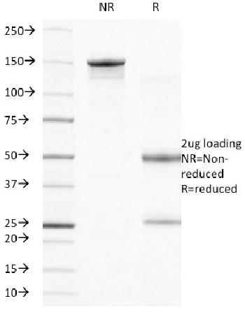 Anti-CD104 (Integrin Beta-4) (Squamous Cell Carcinoma Antigen) Monoclonal Antibody(Clone: UM-A9)