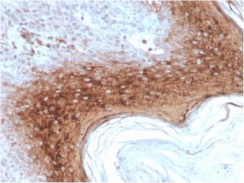 Anti-Involucrin (Squamous Cell Terminal Differentiation Marker) Monoclonal Antibody(Clone: rIVRN/827)