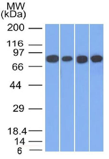 Anti-Catenin, gamma (Cardiomyocyte Marker) Monoclonal Antibody(Clone: 11E4)