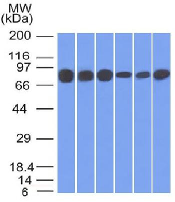 Anti-Catenin, gamma (Cardiomyocyte Marker) Monoclonal Antibody(Clone: 15F11)