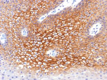 Anti-Catenin, gamma (Cardiomyocyte Marker) Monoclonal Antibody(Clone: CTNG/1483)