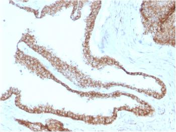 Anti-Catenin, gamma (Cardiomyocyte Marker) Monoclonal Antibody(Clone: CTNG/1664)