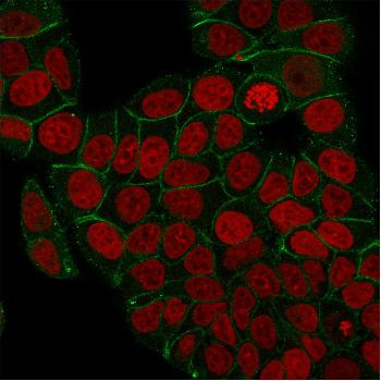 Anti-Catenin, gamma (Cardiomyocyte Marker) Monoclonal Antibody(Clone: rCTNG/1664)