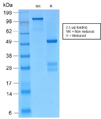 Anti-Catenin, gamma (Cardiomyocyte Marker) Monoclonal Antibody(Clone: CTNG/2155R)