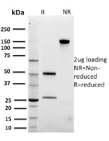 Anti-ARF1 (Golgi Apparatus Marker) Monoclonal Antibody(Clone: 3F1)