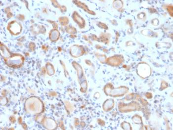 Anti-ARF1 (Golgi Apparatus Marker) Monoclonal Antibody(Clone: ARF1/2117)