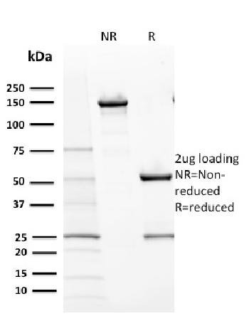 Anti-CD117 / c-Kit (Marker for Gastrointestinal Stromal Tumors) Monoclonal Antibody(Clone: KIT/2670)