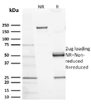 Anti-CD117 / c-Kit (Marker for Gastrointestinal Stromal Tumors) Monoclonal Antibody(Clone: KIT/2673)