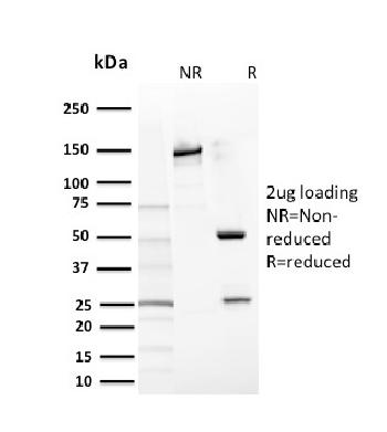 Anti-CD117 / c-Kit (Marker for Gastrointestinal Stromal Tumors) Monoclonal Antibody(Clone: KIT/2669)