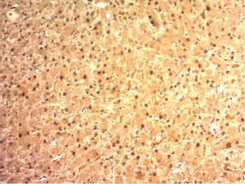 Anti-Arginase 1 (Hepatocellular Carcinoma Marker) Monoclonal Antibody(Clone: ARG1/1125)