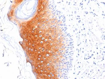 Anti-Cytokeratin 1 (Suprabasal Keratinocyte Marker) Monoclonal Antibody(Clone: LHK1)