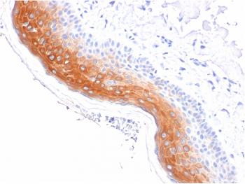 Anti-Cytokeratin 1 (Suprabasal Keratinocyte Marker) Monoclonal Antibody(Clone: KRT1/1840)