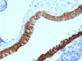 Anti-Cytokeratin 3 (KRT3) (Corneal Epithelial Marker) Monoclonal Antibody(Clone: KRT3/2130)